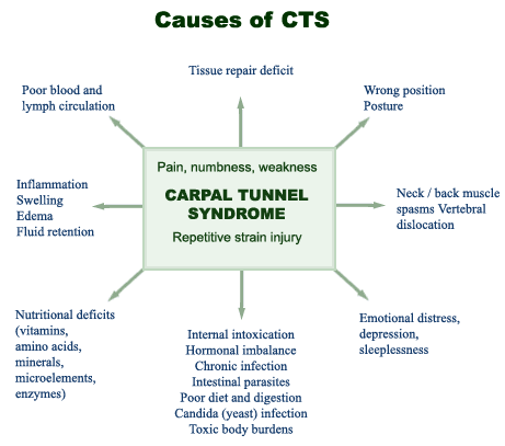 carpal tunnel symptoms. Carpal Tunnel Syndrome (CTS)