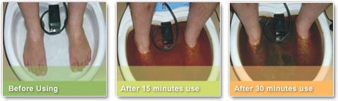 Source: http://www.footbathdetox.com/