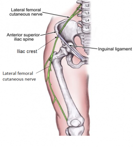 Meralgia paresthetica (Bernhardt-Roth syndrome) Picture Lateral femoral subcutaneous nerve. 1png 271x300 - Meralgia paresthetica (Bernhardt-Roth syndrome)