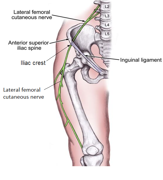 Lateral femoral