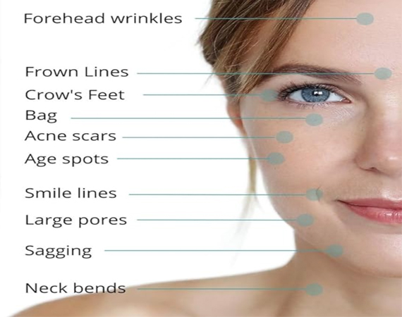 San Francisco Bay Facial Skin Toning Clinic facial muscular - San Francisco Bay Facial Skin Toning Clinic
