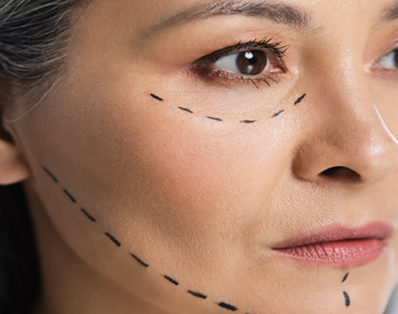 San Francisco Bay Facial Skin Toning Clinic facial skin 1 - San Francisco Bay Facial Skin Toning Clinic