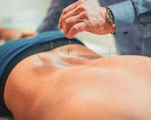 lower back pain acupuncture 300x237 - Acupuncture in San Francisco with Felix Melamed, LAc