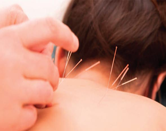 Neck Pain 3 - Neck Pain Acupuncture at Biotherapy Clinic, in San Francisco